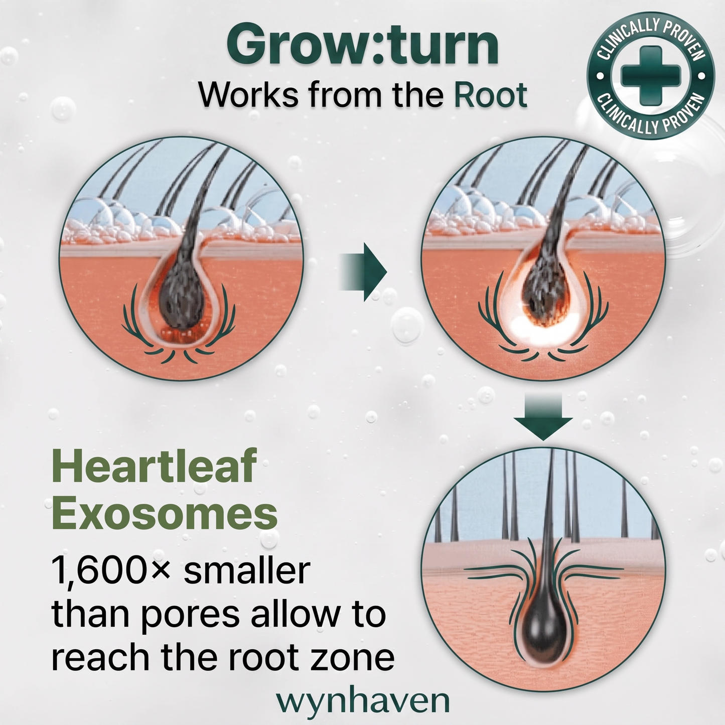 Rootwyn Serum - Scalp Growth Serum with Brush 100ml